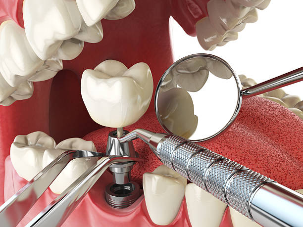 Best Emergency Dental Care for Broken or Chipped Teeth in Adrian, MI